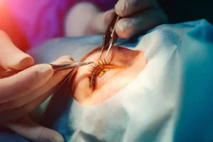 Invasive VS Non-Invasive Eye Treatments: Which Is Right For You?