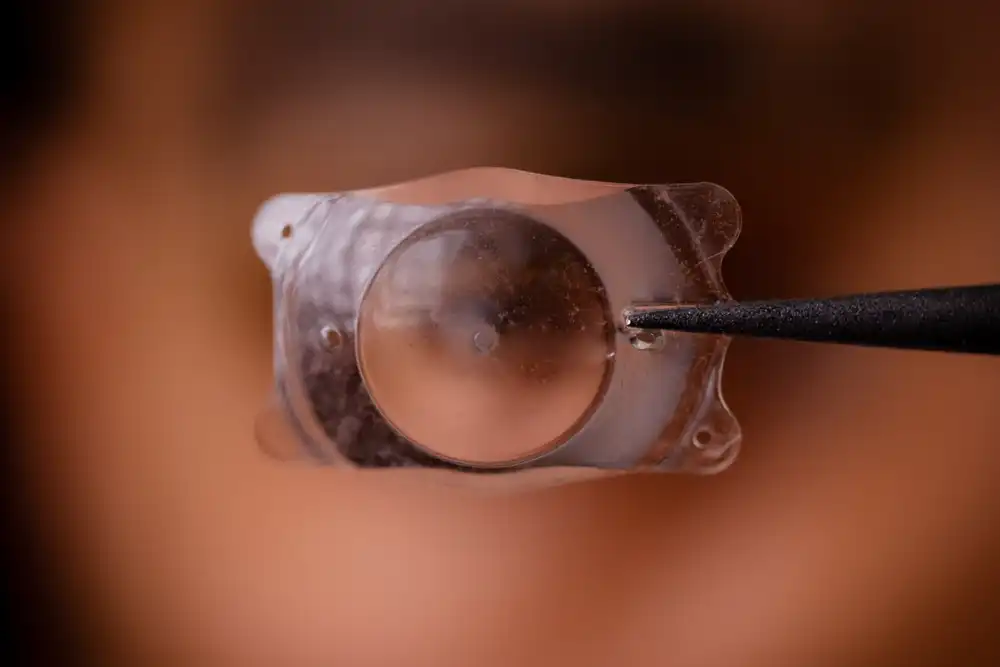 Is Refractive Lens Exchange Right For You?