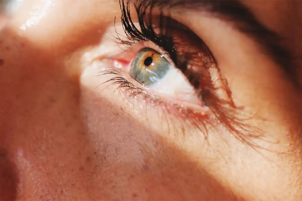 Laser Iridotomy for Glaucoma- What to Expect